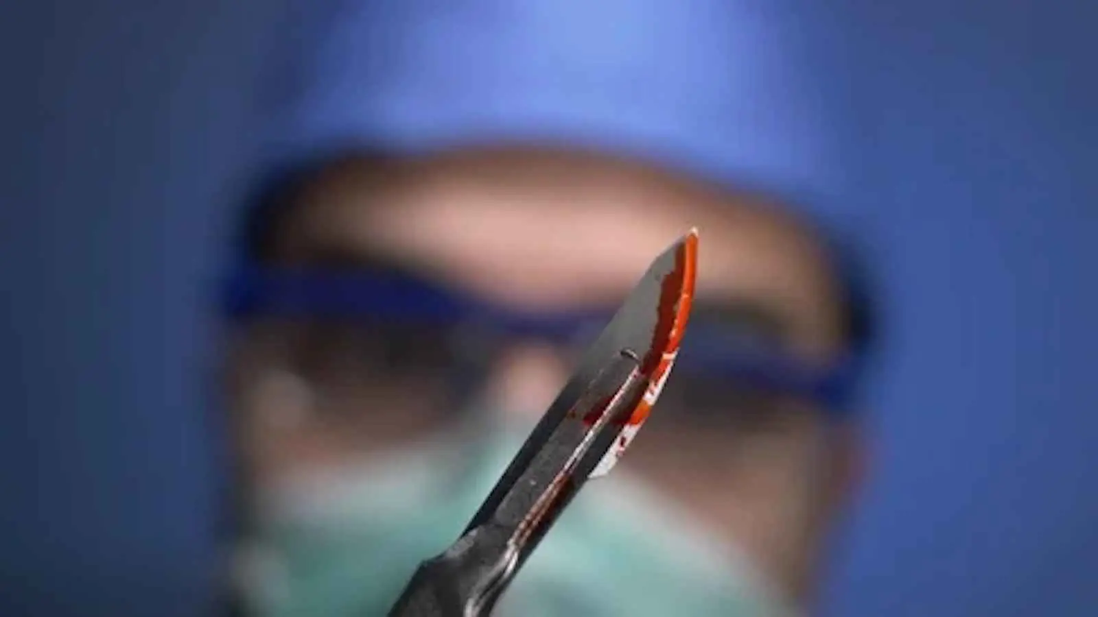 العراق.. طبيب يطعن مراجعاً بسكين ويلوذ بالفرار