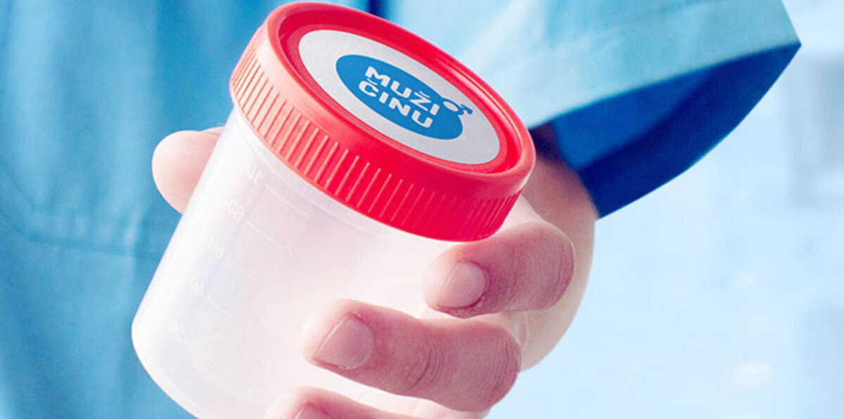 خدمة جديدة لفحص السائل المنوي