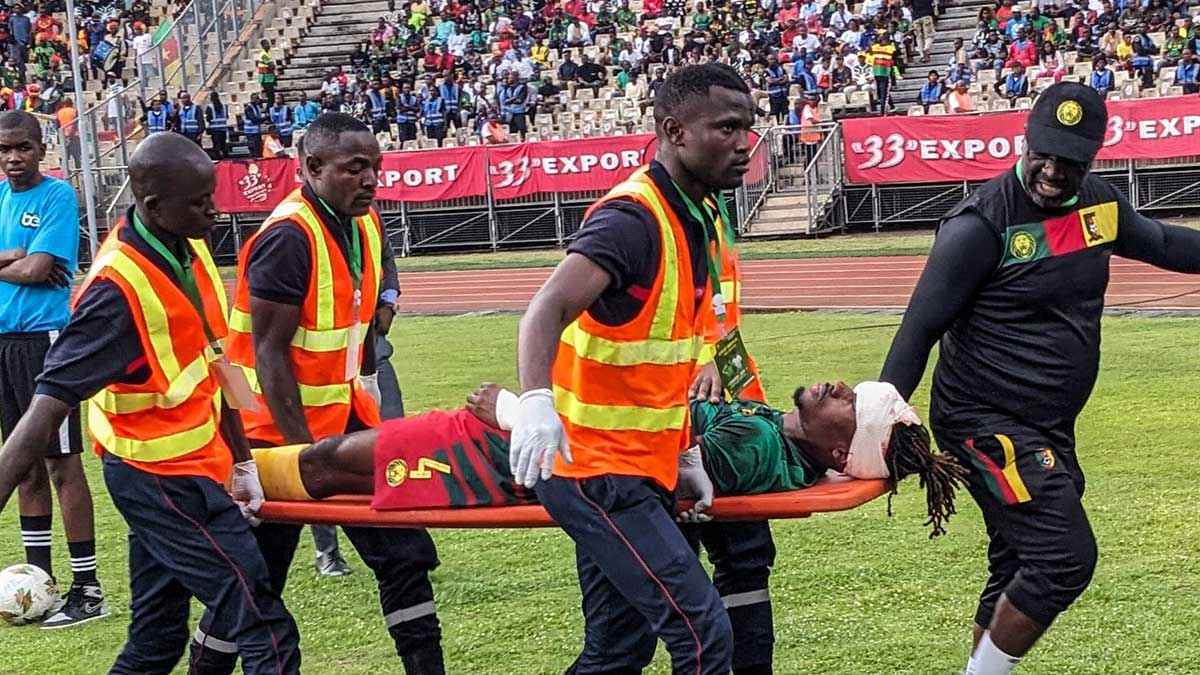 تطورات الحالة الصحية لمهاجم الكاميرون بعد تعرضه لإصابة خطيرة بالرأس