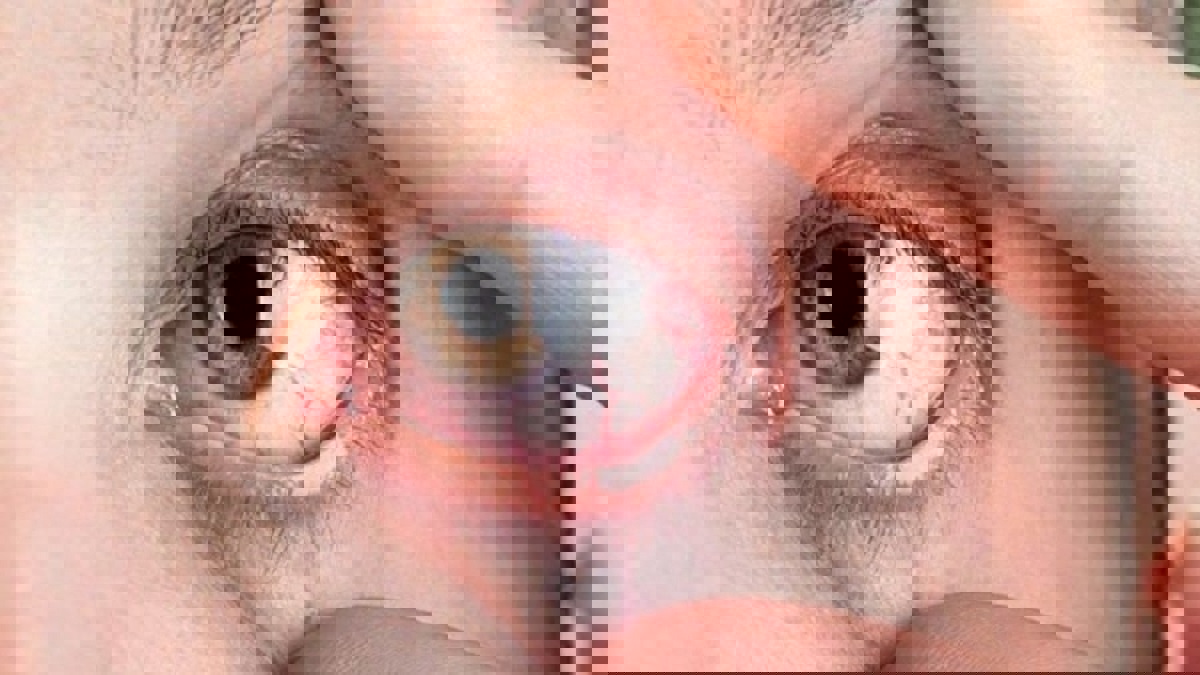 أطعمة تحارب ظاهرة جفاف العيون في فصل الشتاء