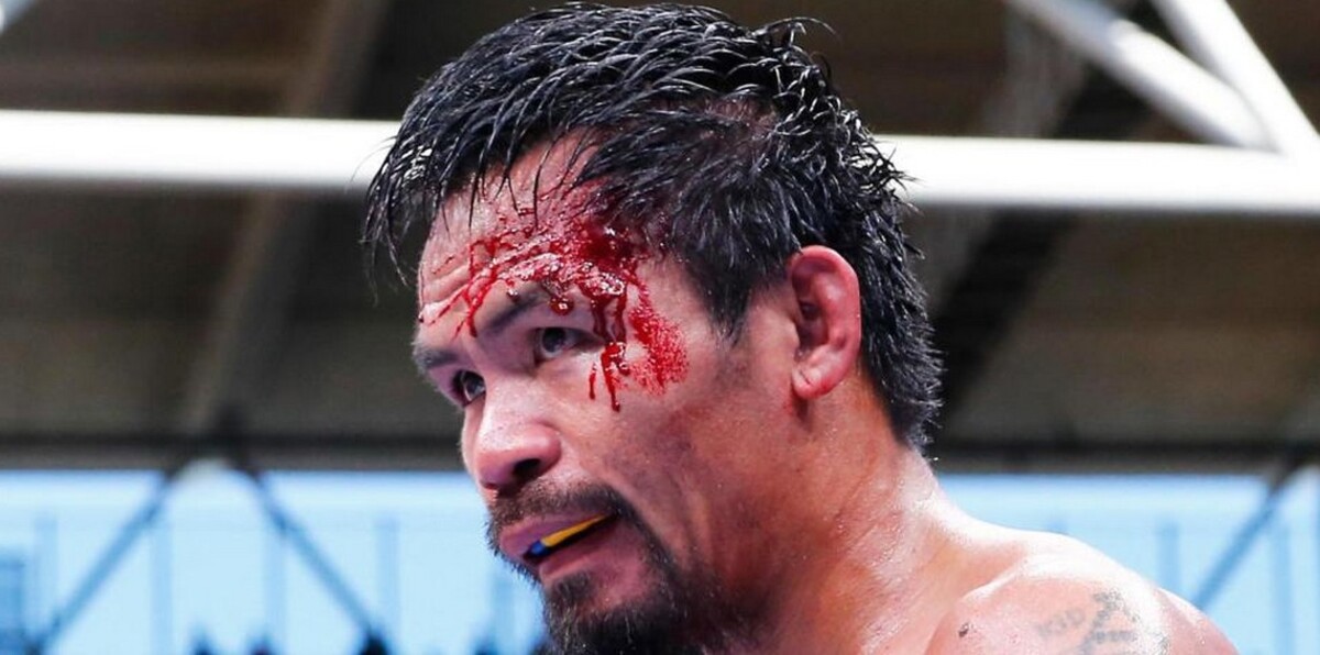 الملاكم باكياو يوزع أموالًا على فقراء الفلبين (فيديو)