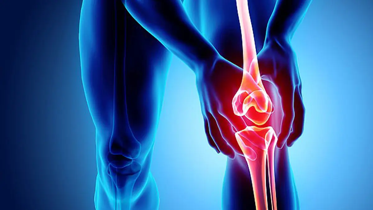 الكشف عن علاج جديد لآلام المفاصل والغضاريف