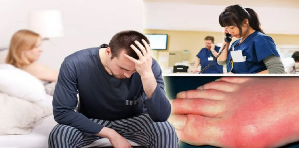 هل يؤدي النقرس إلى الضعف الجنسي لدى الرجال؟