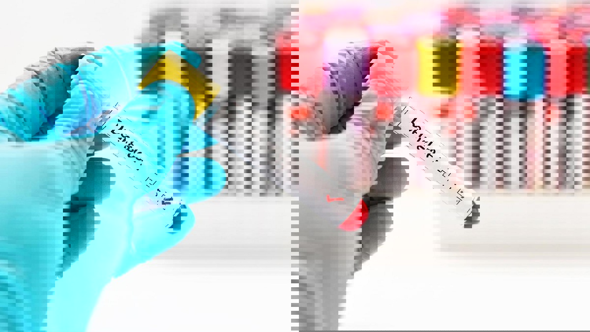 "حمى القرم" ينتشر في إيران ويودي بحياة 10 أشخاص