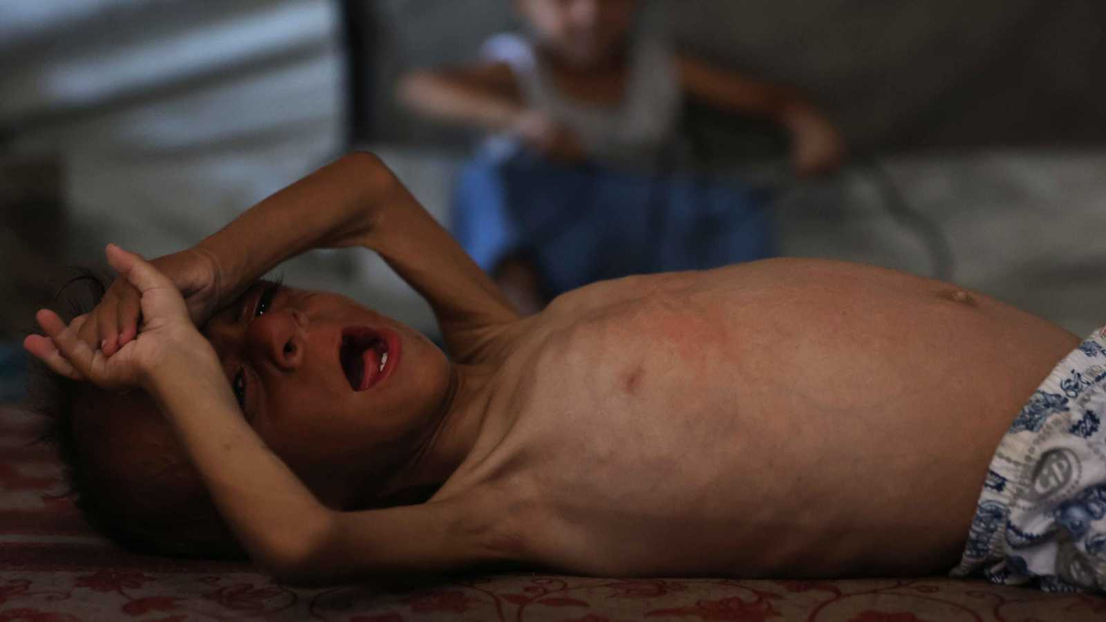 ستارمر يدعو لمباحثات أوروبية عاجلة حول "المعاناة والمجاعة" في غزة