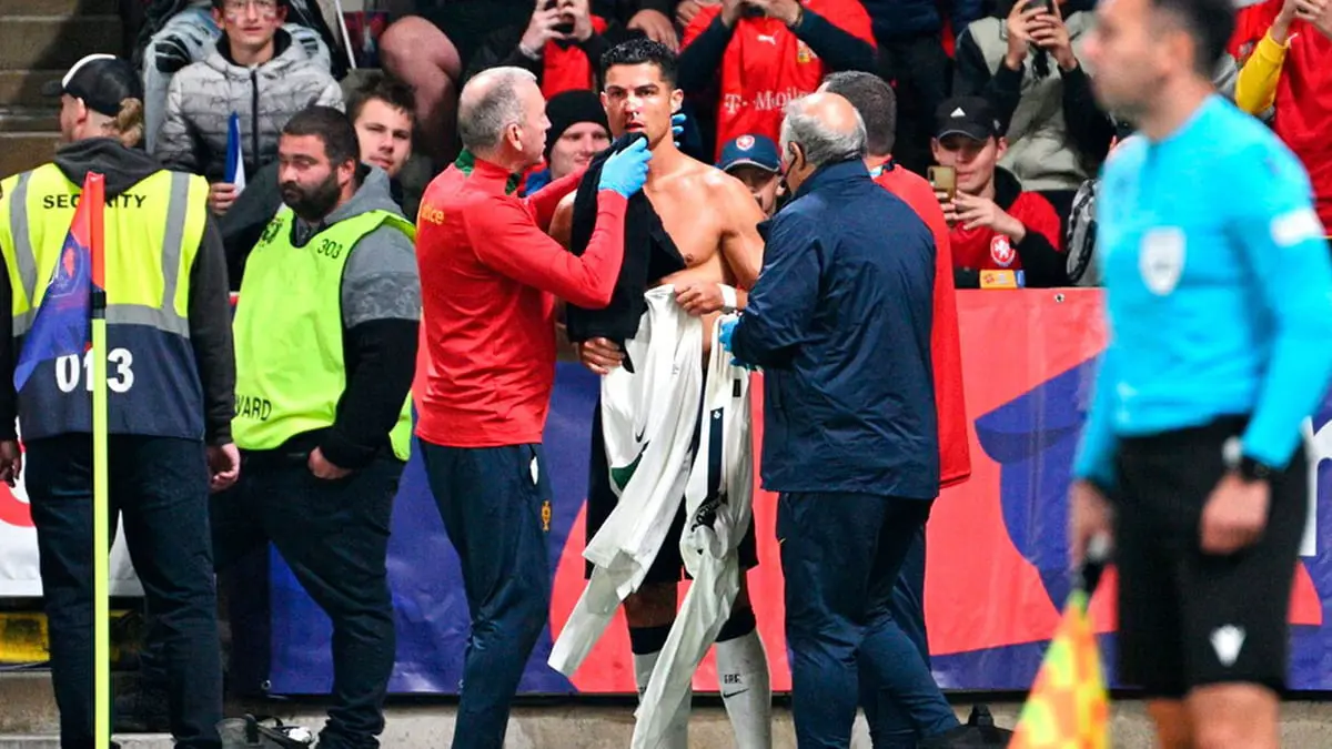 كريستيانو رونالدو يتعرض لإصابة قوية في أنفه خلال مباراة البرتغال ضد التشيك (فيديو)