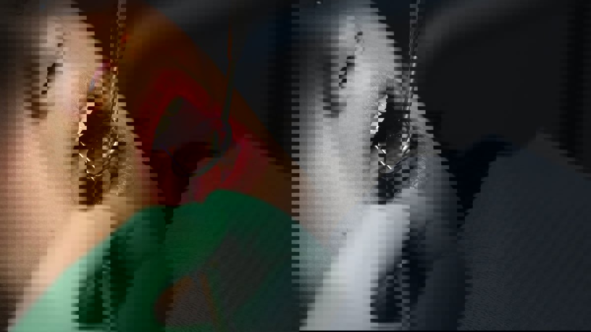 امرأة ترفع دعوى على طبيب أسنان أجرى لها 30 عملية بيوم واحد