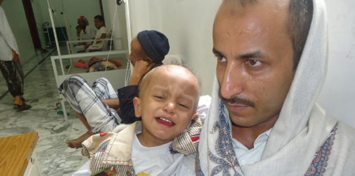 94 وفاة بالدفتيريا في اليمن خلال 6 أشهر