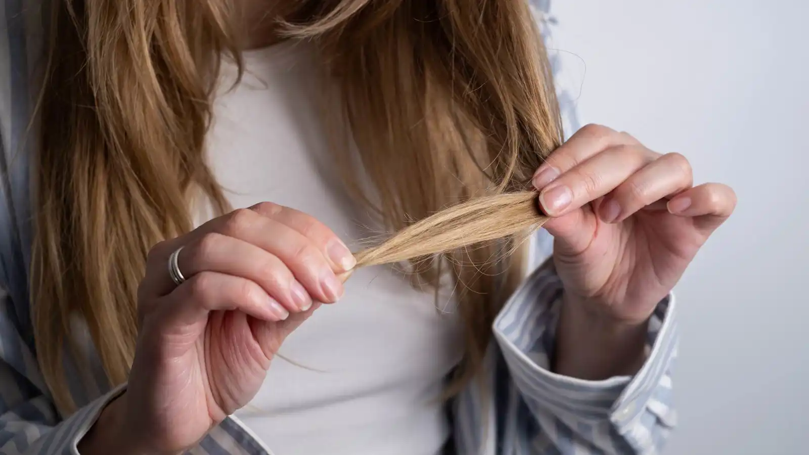 لماذا تظهر أعراض نقص الفيتامينات على الوجه والشعر؟