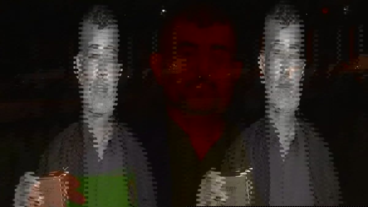 عراقي أصيب بـ"تشوهات" بسبب "شامبو" يكشف تفاصيل الواقعة