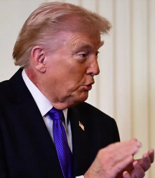 ظهر الرئيس دونالد ترامب مصاباً بطفح جلدي كبير في رقبته