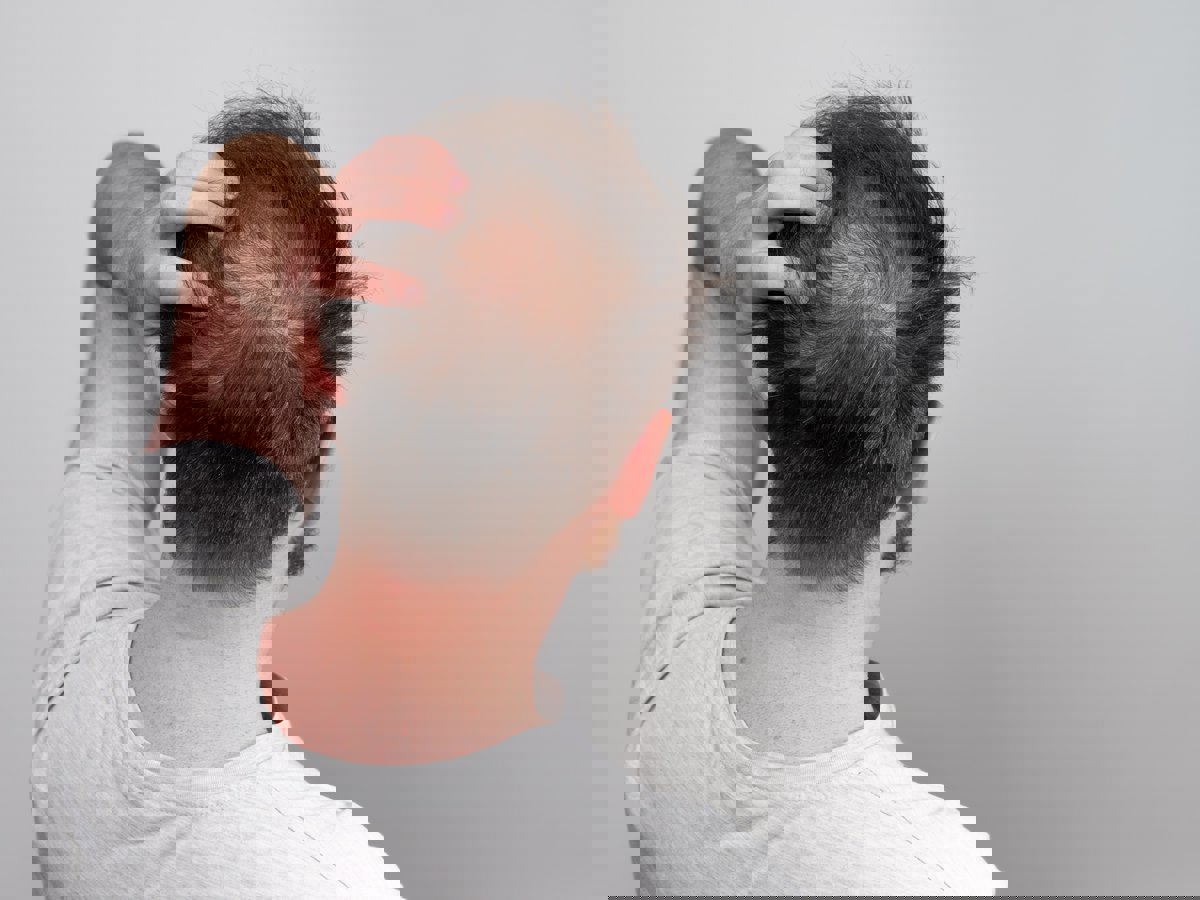 طبيب يكشف عن 5 أطعمة تحارب الصلع وتعزز نمو الشعر