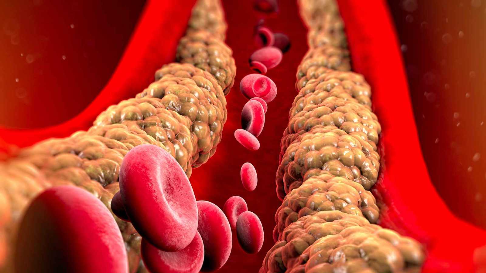 خفض الكوليسترول ممكن من دون أدوية.. وهذان العاملان هما السر