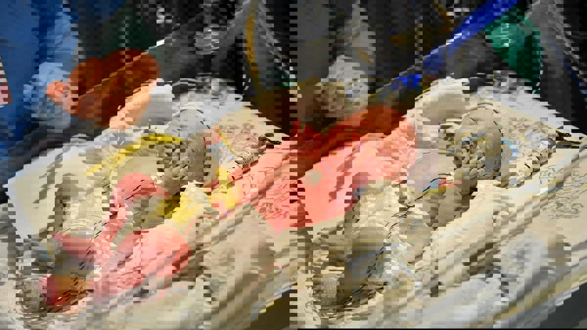 تقنية لفحص أدمغة المواليد الخدج بالموجات فوق الصوتية