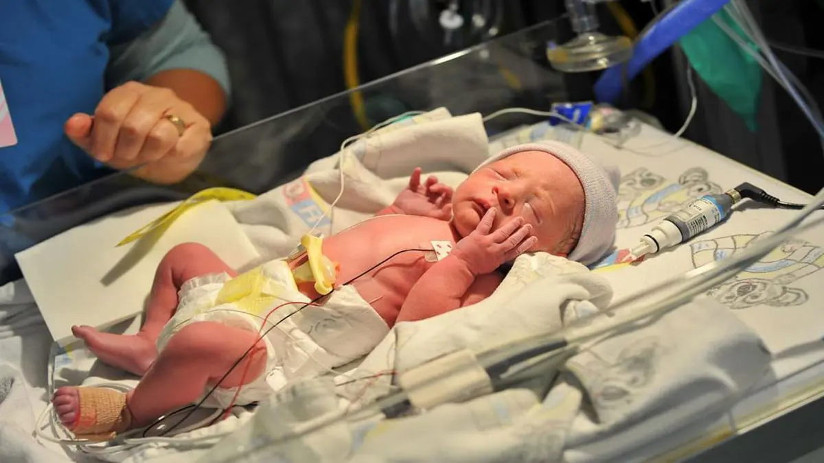 تقنية لفحص أدمغة المواليد الخدج بالموجات فوق الصوتية