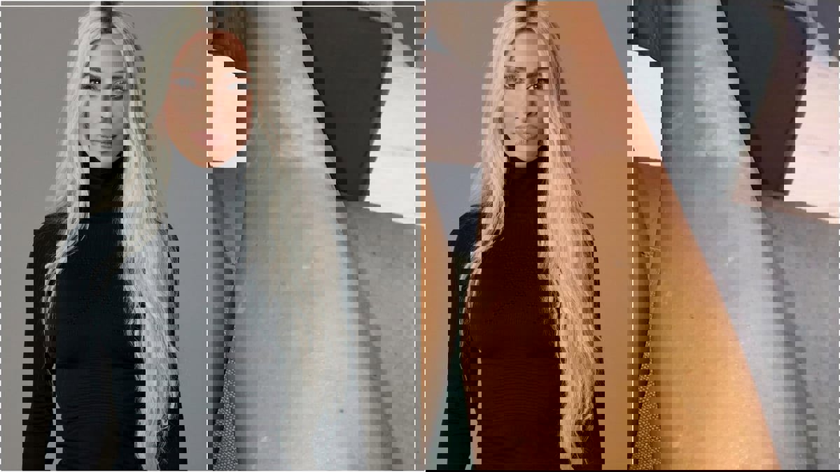 ما الصدفية ؟ مرض أصاب عددًا من المشاهير بينهم كيم كارداشيان