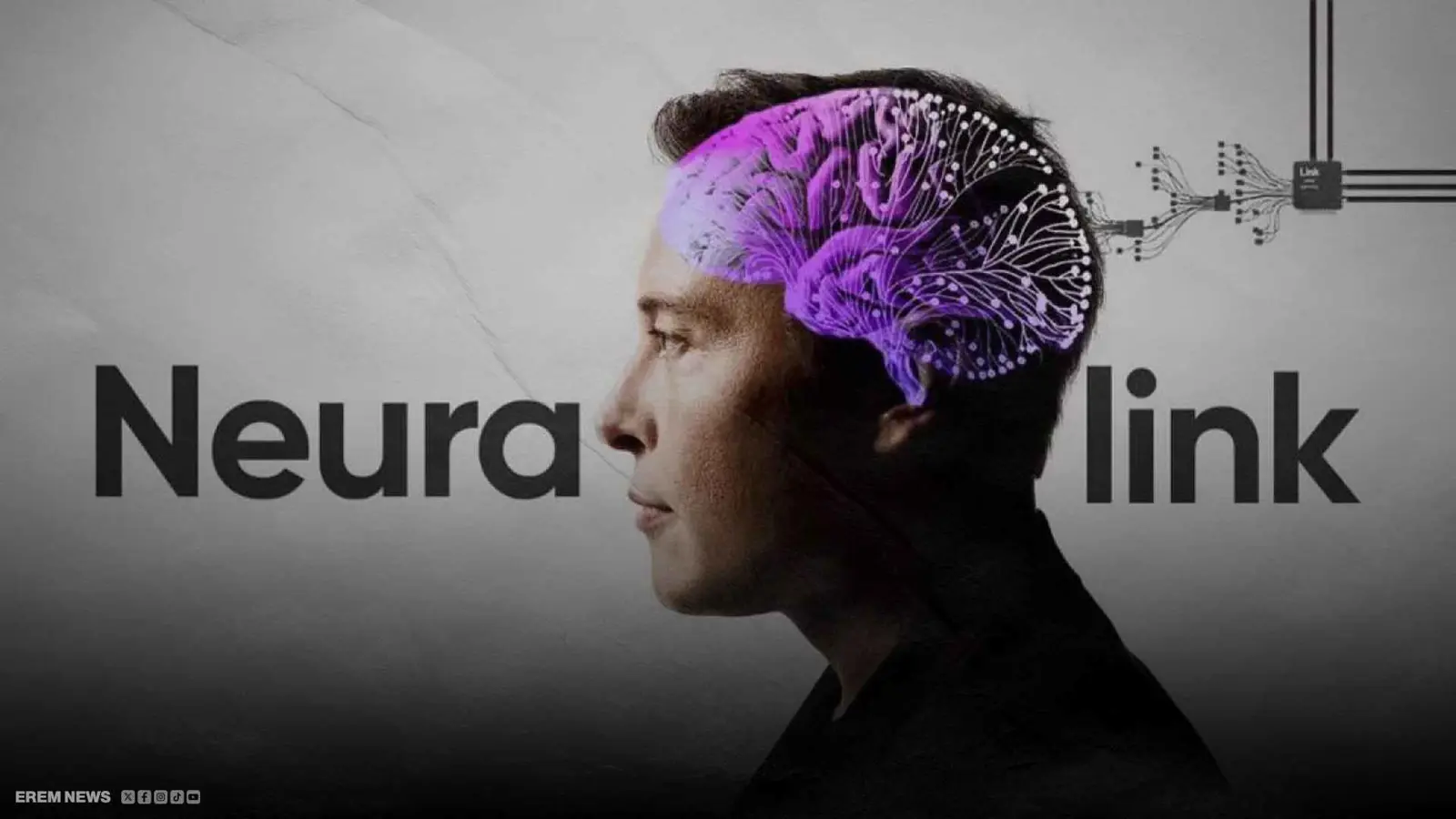 ستبصرون هذا العام.. ماسك يزرع الأمل في أدمغة المكفوفين