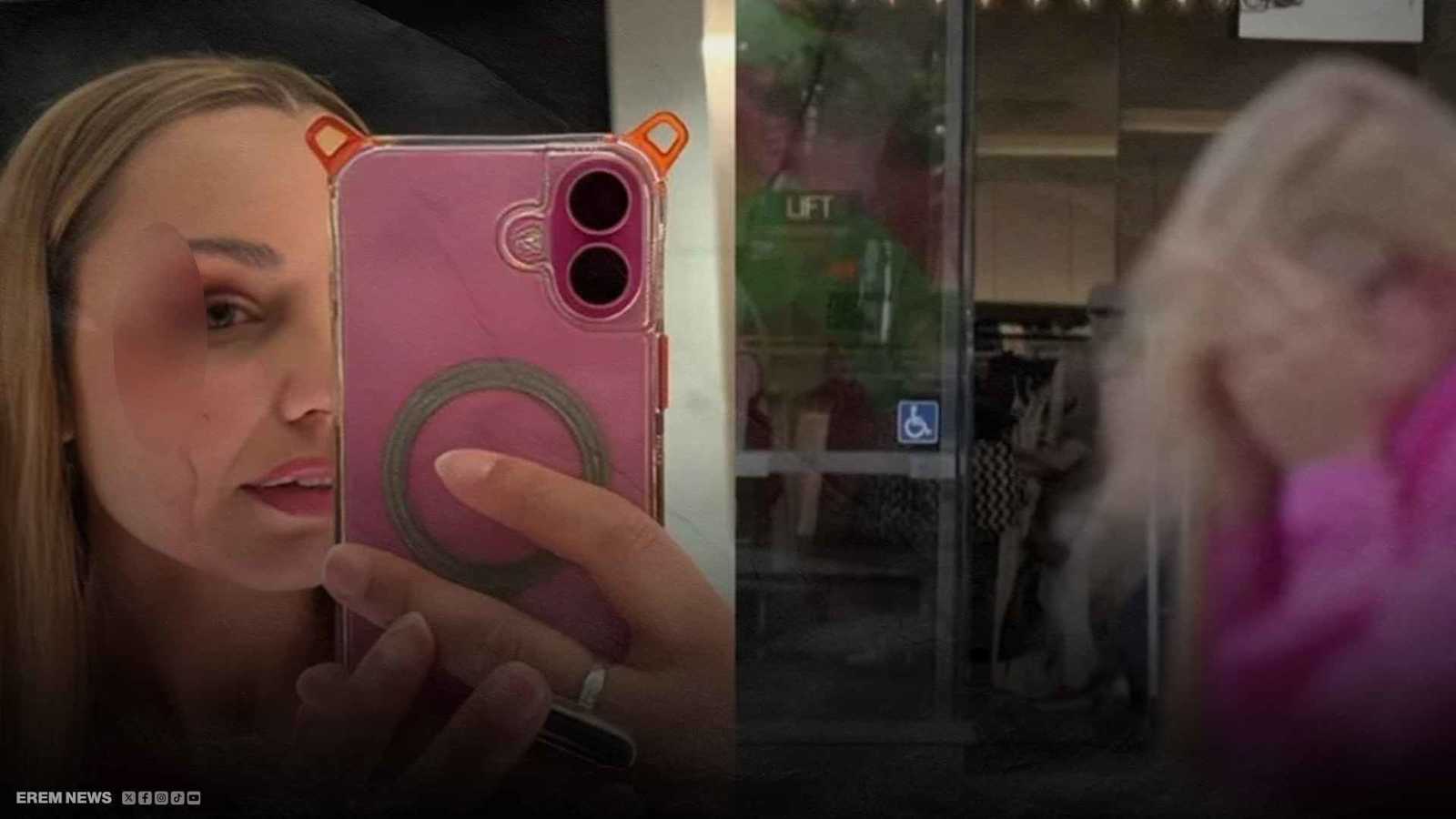 كاد أن يصيب عينها.. طائر يهاجم مراسلة تلفزيونية (فيديو إرم)