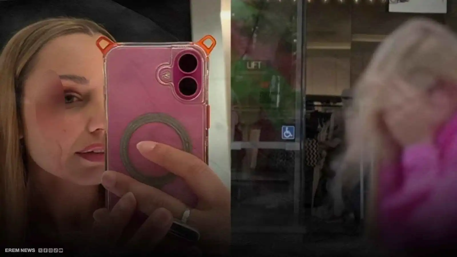 كاد أن يصيب عينها.. طائر يهاجم مراسلة تلفزيونية (فيديو إرم)