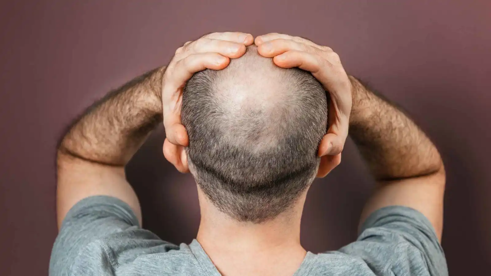 في شكوى رسمية.. امرأة تتهم زوجها بخداعها وإخفاء "صلعه"