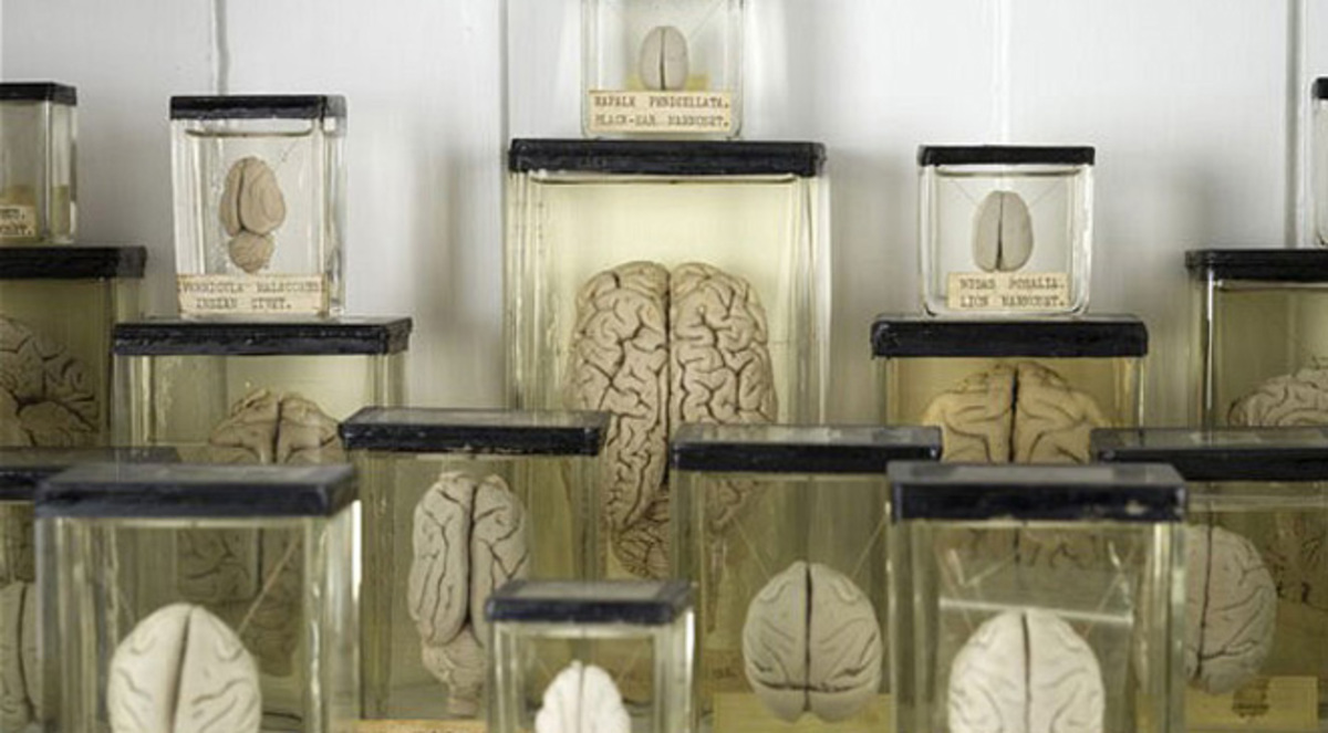 اختفاء 100 دماغ بشري من جامعة تكساس