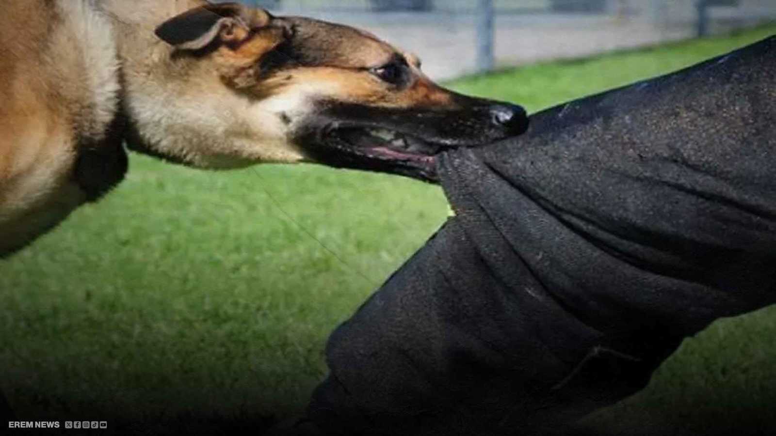 أحدهم عض ساقه.. كلاب ضالة تهاجم مسؤولا عراقيا (فيديو إرم)