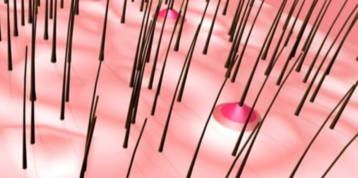 علاج الخلايا التالفة باستخدام بصيلات الشعر