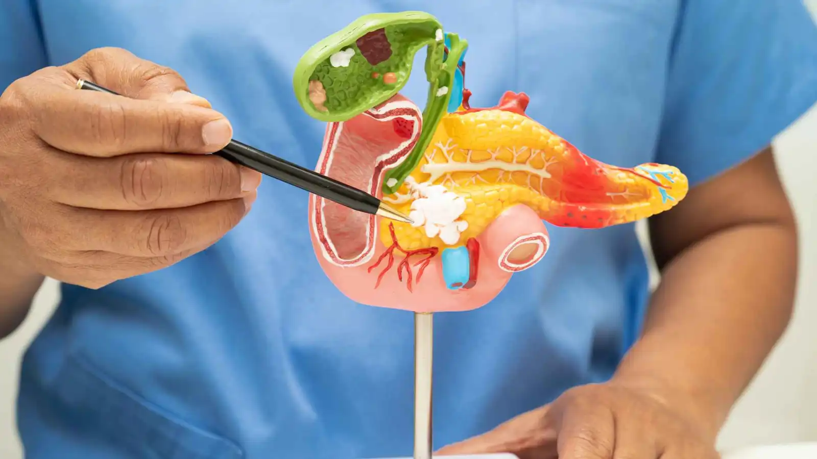 كيف تحمي نفسك من تكرار نوبات التهاب المرارة؟