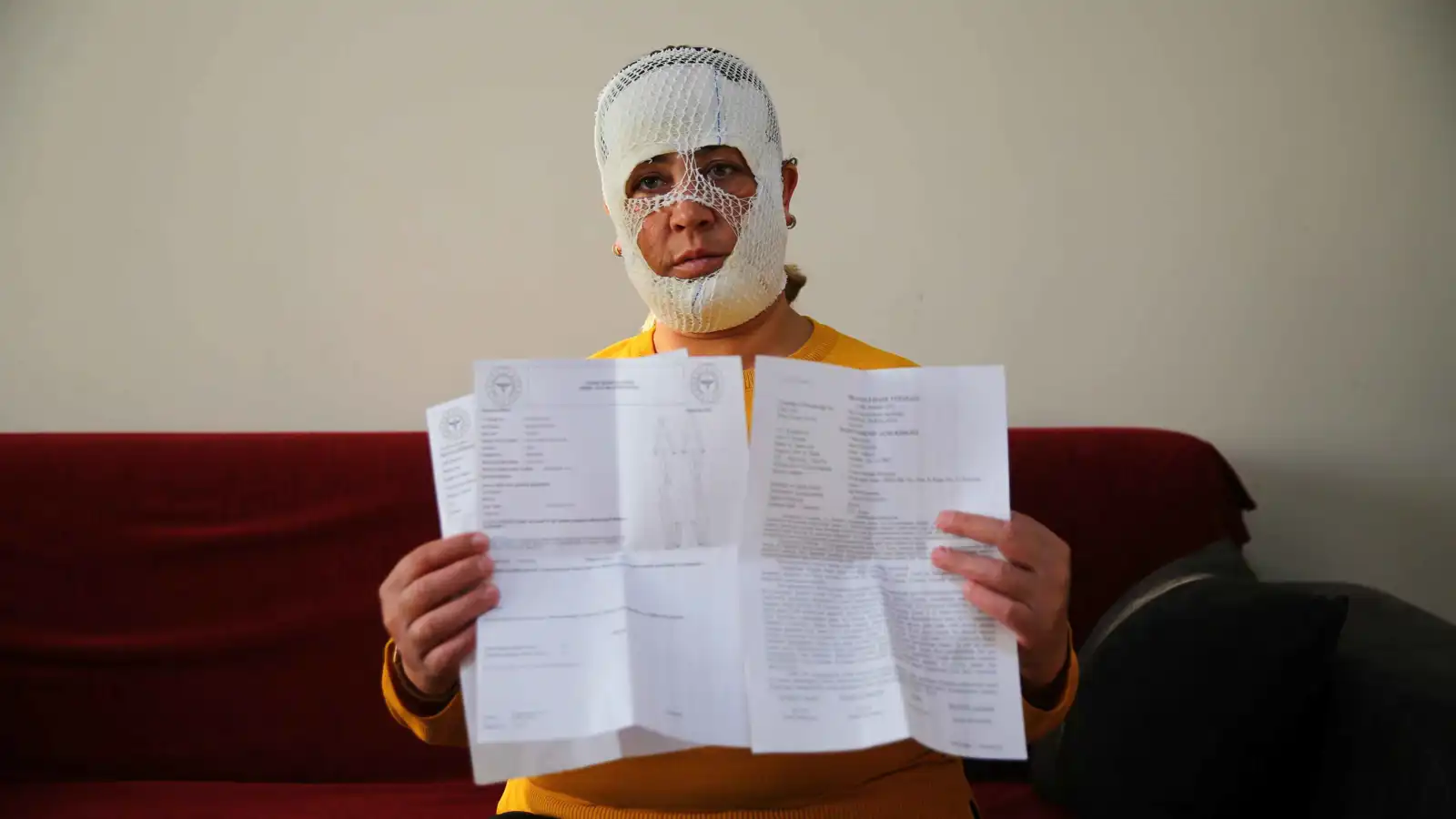 من "أميرة" إلى وحش.. أم تركية تخسر وجهها في مركز تجميل (فيديو)