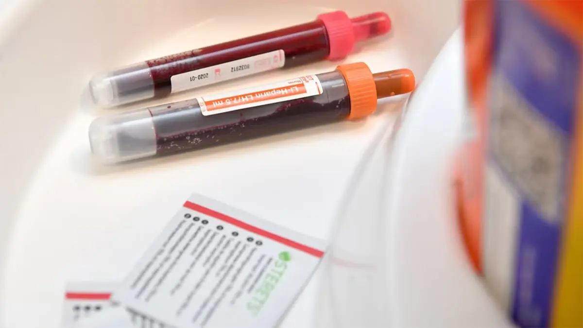 اختبار جديد للدم يُبشر بالكشف المبكر عن "اللوكيميا"‎‎