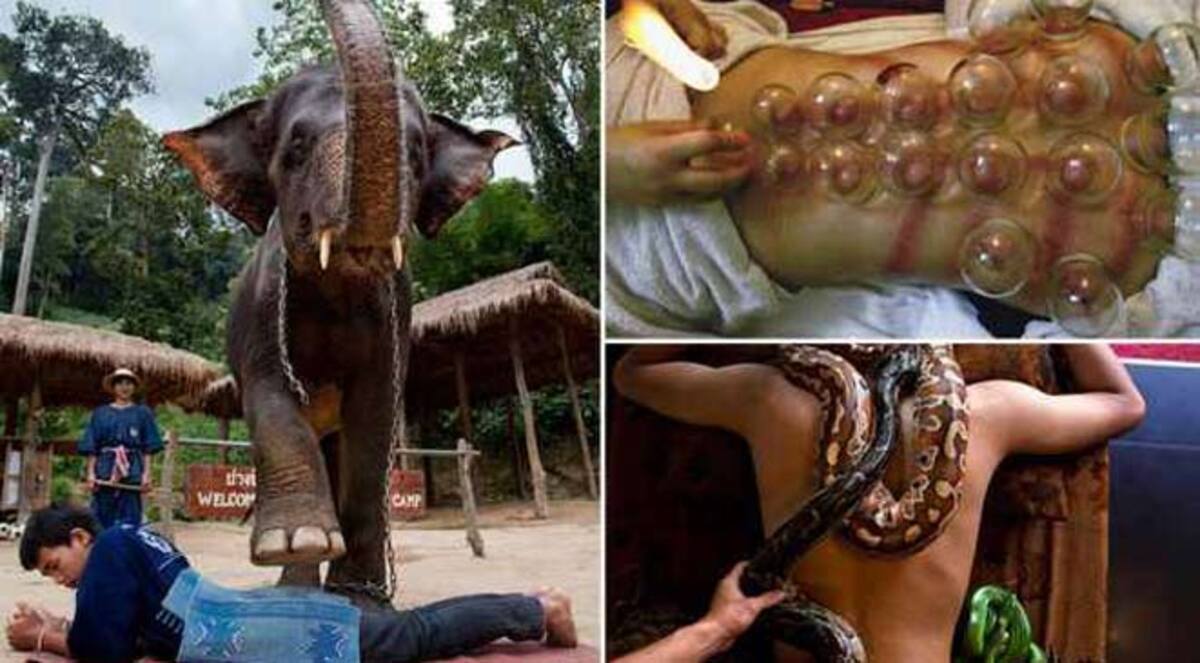 صور.. شاهد أغرب علاجات الطب البديل في العالم