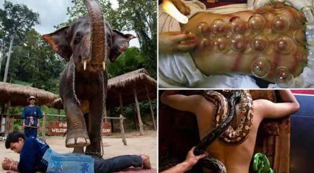 صور.. شاهد أغرب علاجات الطب البديل في العالم