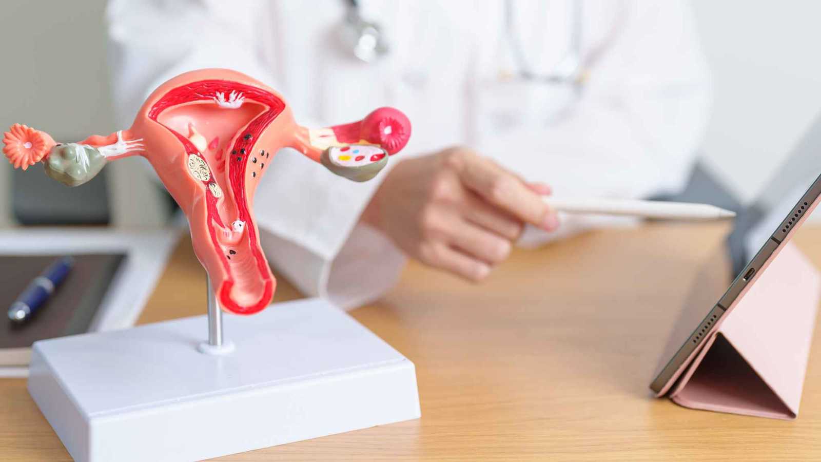 استئصال الرحم والمبيضين يزيد خطر الإصابة بالسكتة الدماغية