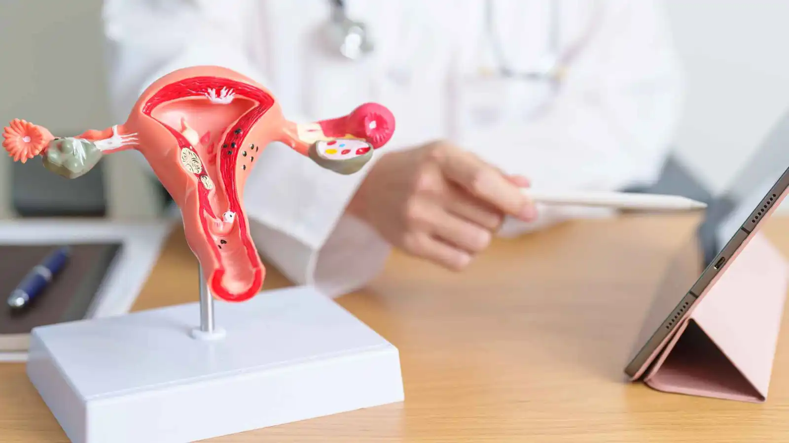 استئصال الرحم والمبيضين يزيد خطر الإصابة بالسكتة الدماغية