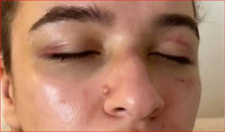 زوجة محمود حجازي تتعرض للضرب