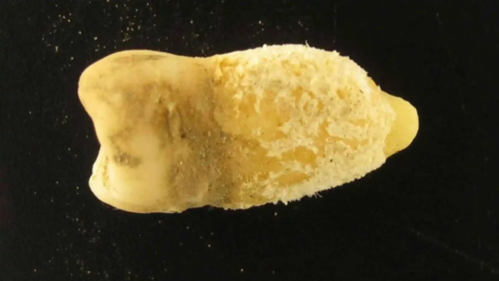 سنّ مومياء بوليفية تعيد كتابة تاريخ الحمى القرمزية