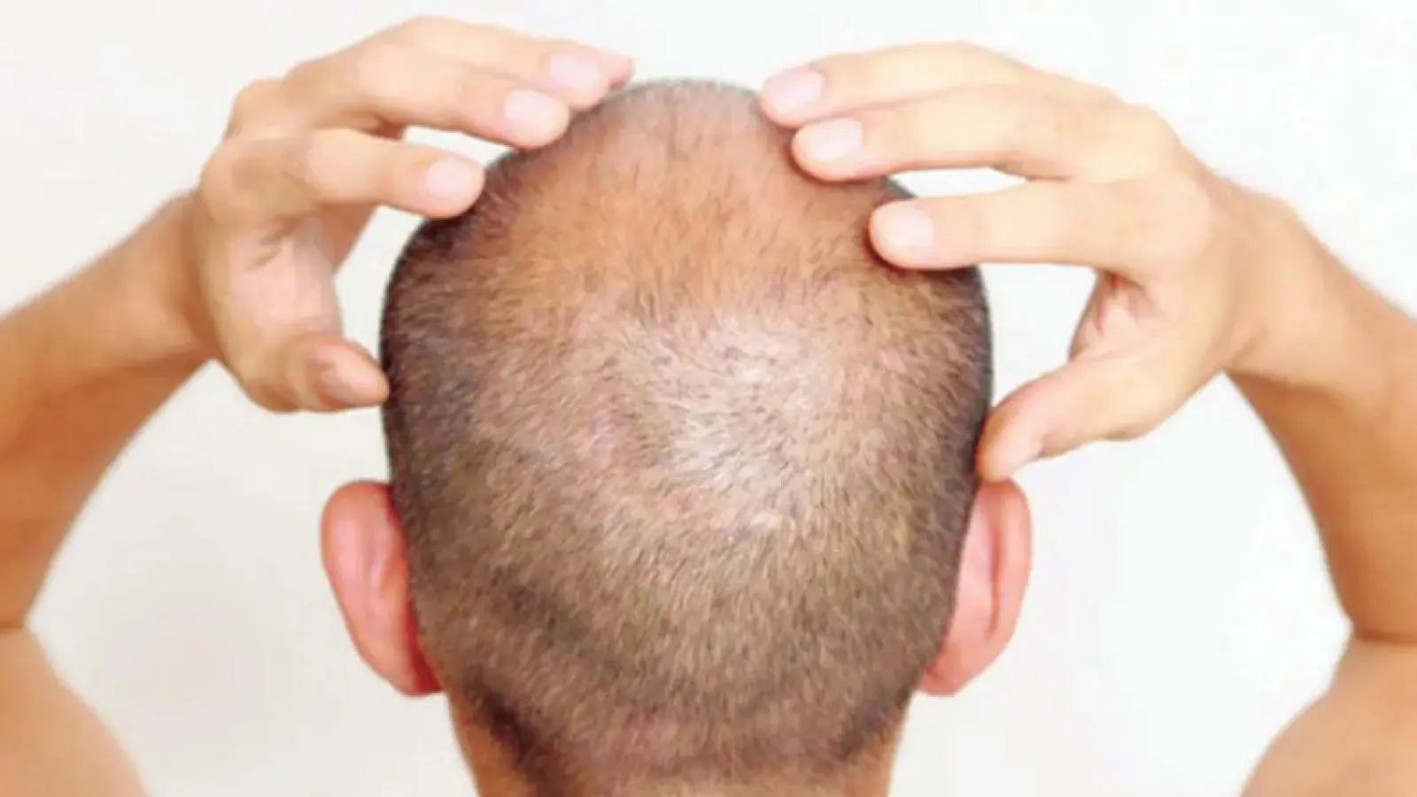 قوي ومدهش.. هل جربت هذا العصير لتعزيز نمو الشعر؟