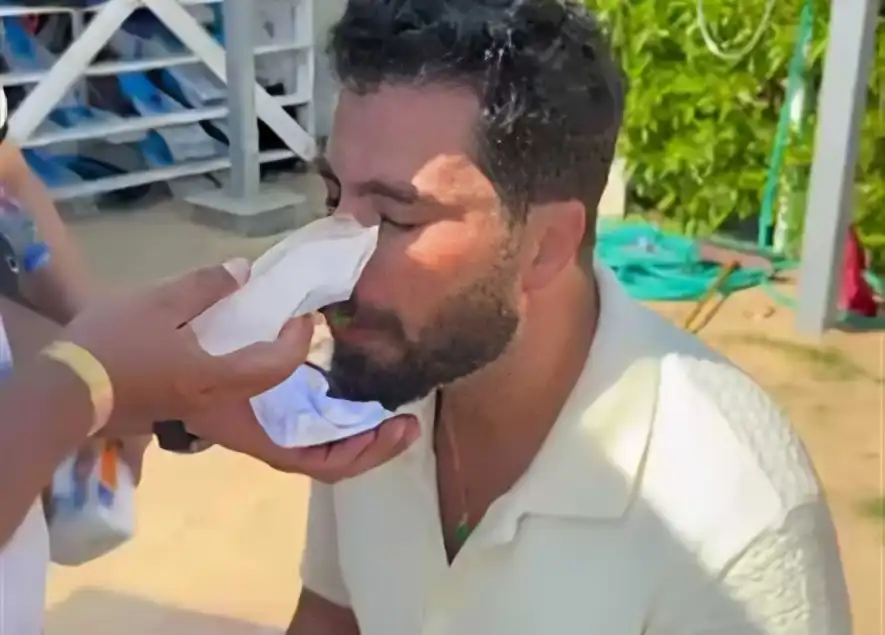 إصابة معتصم النهار خلال تصوير فيلم "نصيب"