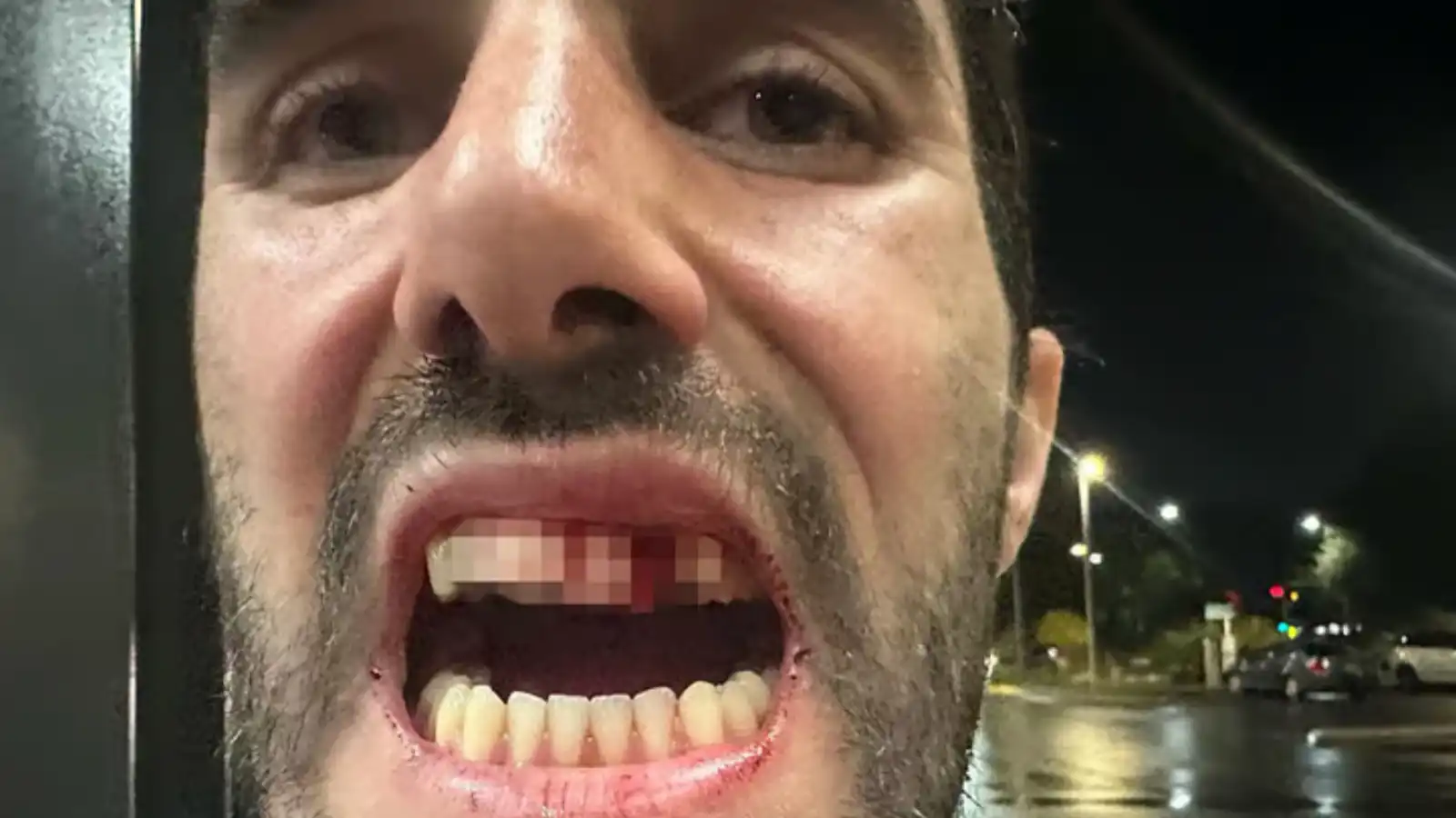 جندي الاحتياط الإسرائيلي يوفال شيكل عقب الحادثة