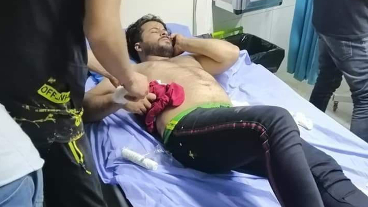 إصابة 23 شخصا في هجوم استهدف حفل زفاف جنوب العراق