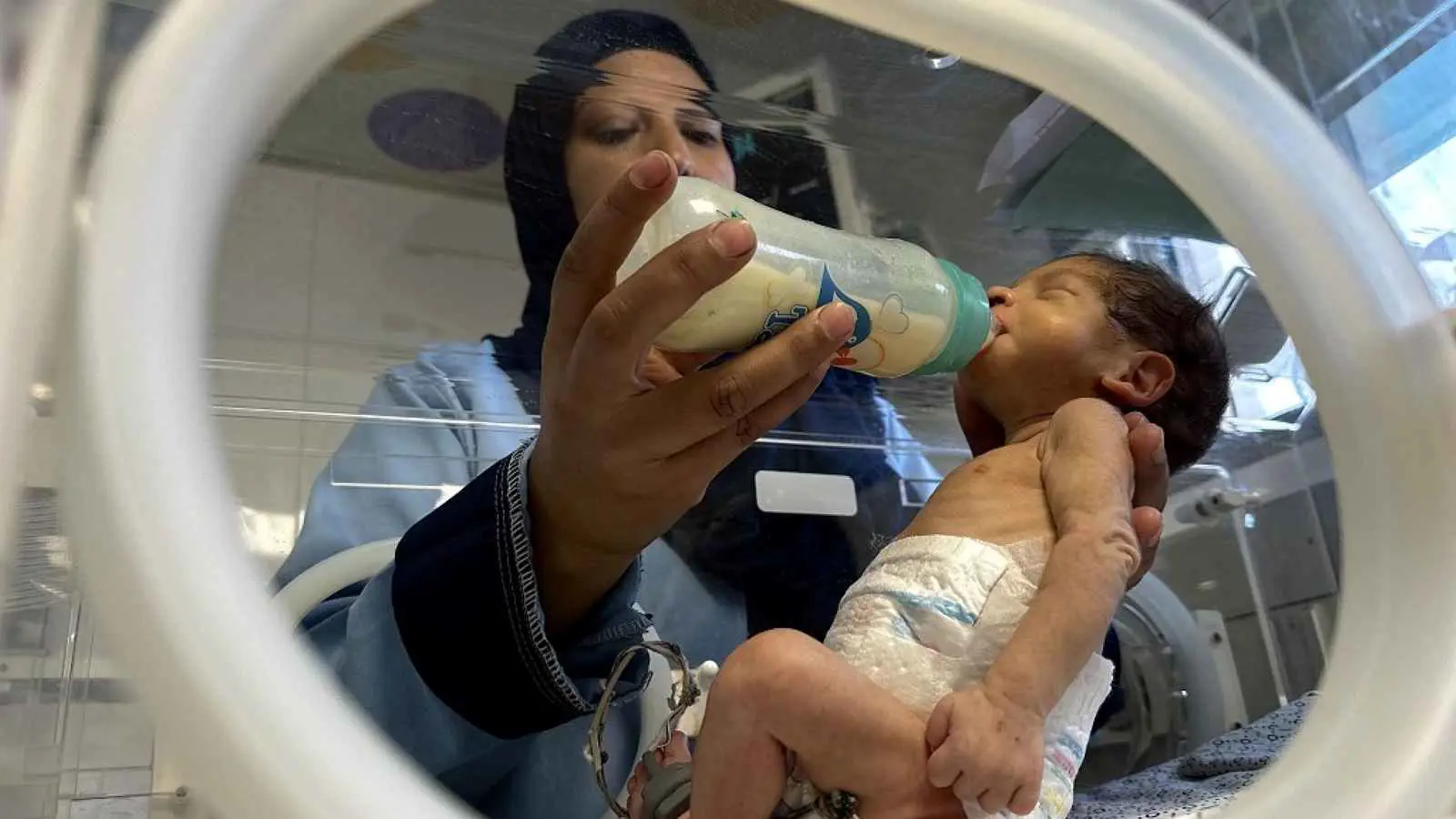 حصيلة مؤلمة.. "الجوع" يخطف رضيعين في غزة