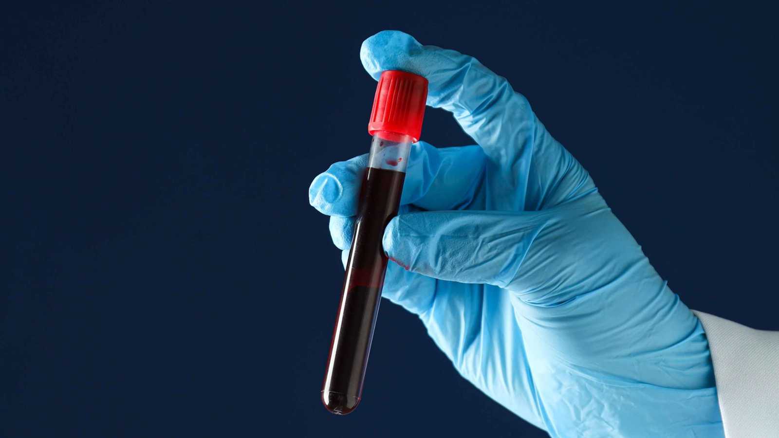 4 اختبارات دم ضرورية للساعين إلى الـ100 سنة