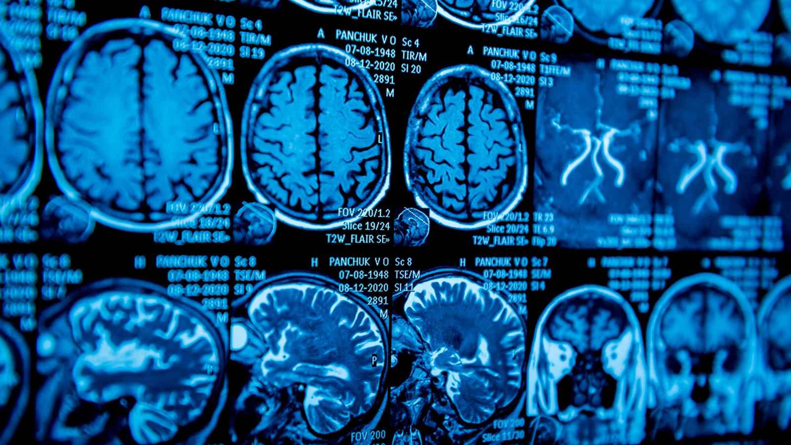 ثورة تقنية.. الذكاء الاصطناعي يمنح "الأفكار" صوتاً