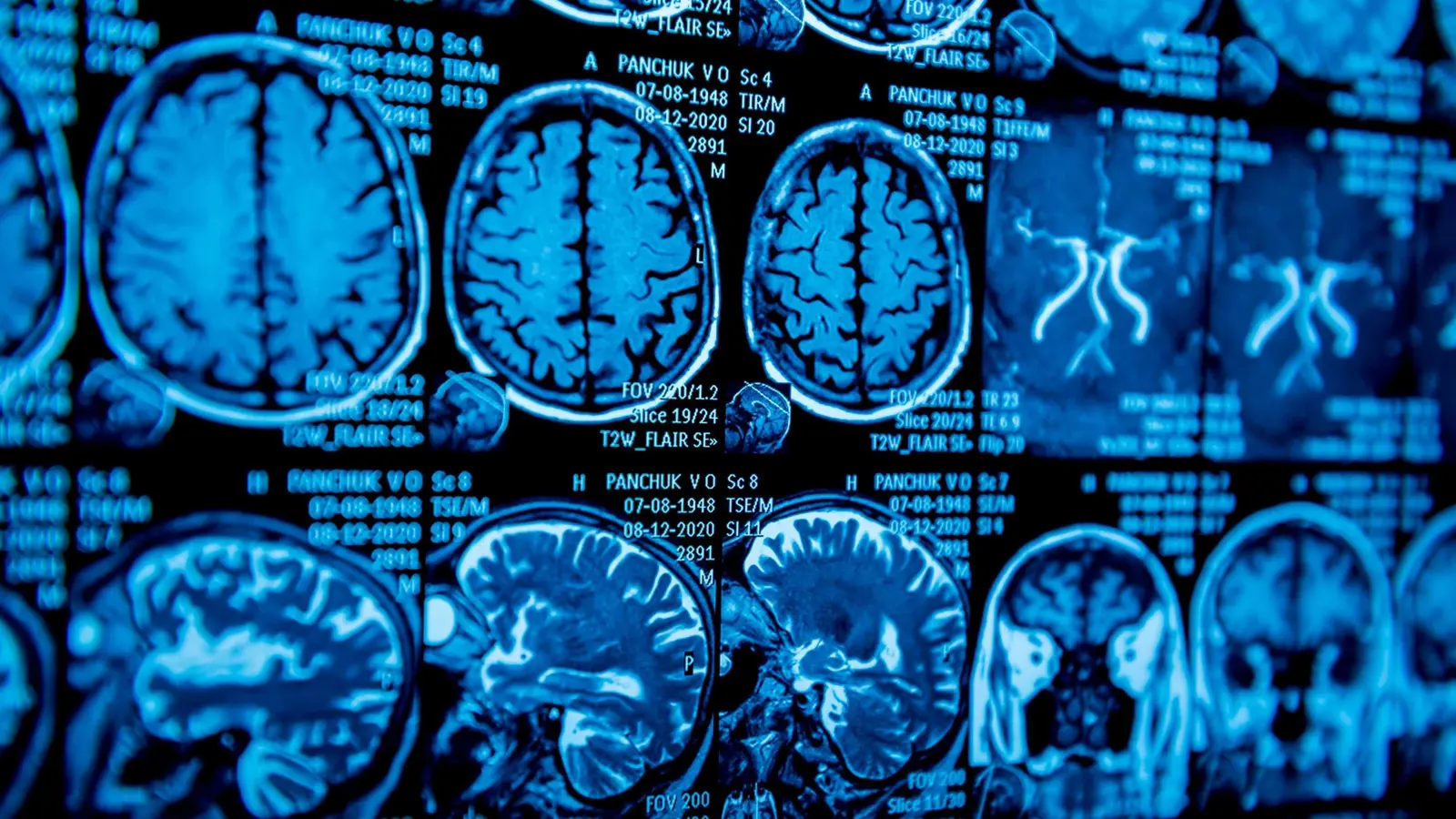 ثورة تقنية.. الذكاء الاصطناعي يمنح "الأفكار" صوتاً