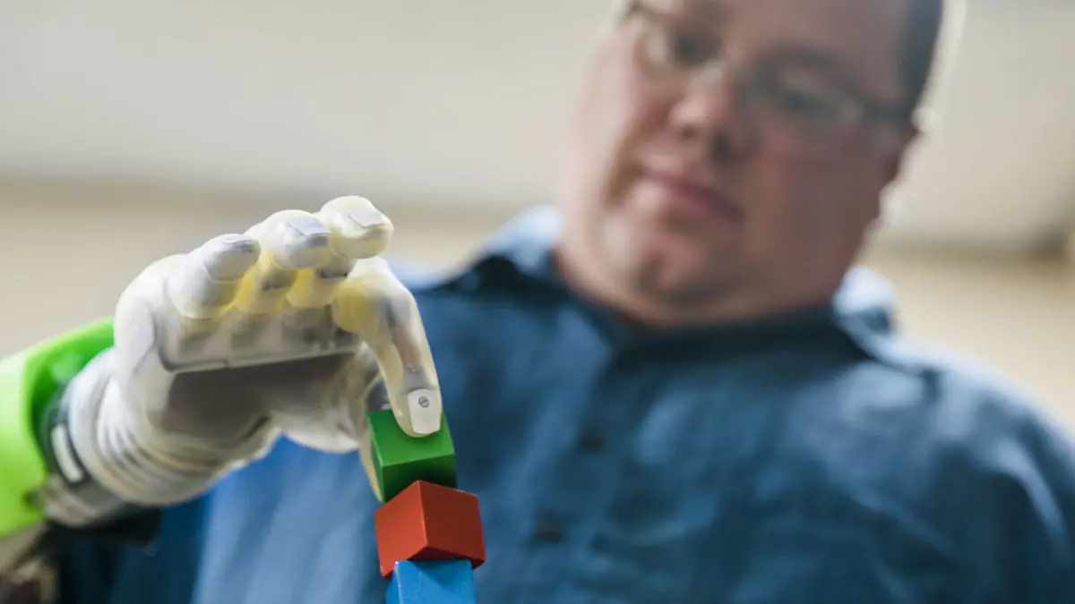 تطوير أطراف اصطناعية علوية أكثر اندماجا مع العضلات