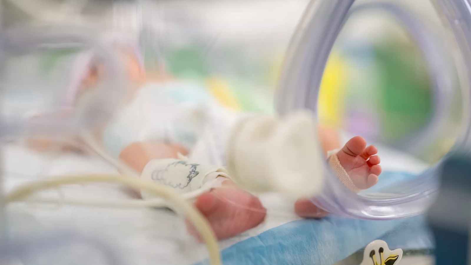 "غير مسبوق".. جامعة مصرية تنجح في فصل توأم ملتصق الرأس (صور)‎