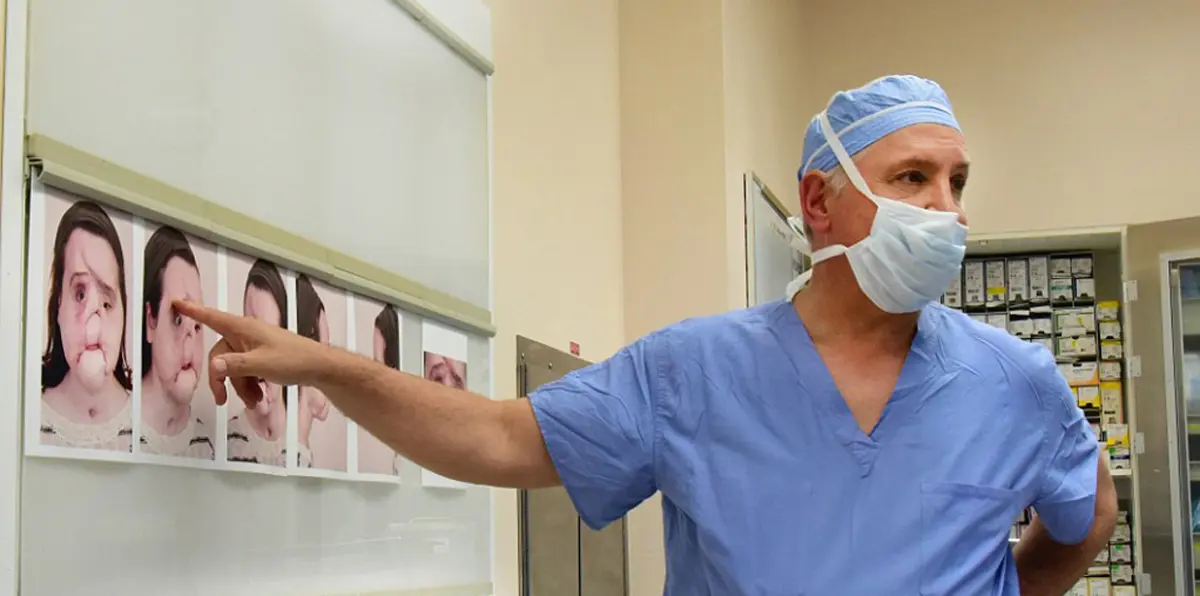 في جراحة استغرقت 31 ساعة.. شاهد أصغر شخص يخضع لعملية زراعة وجه (صور)