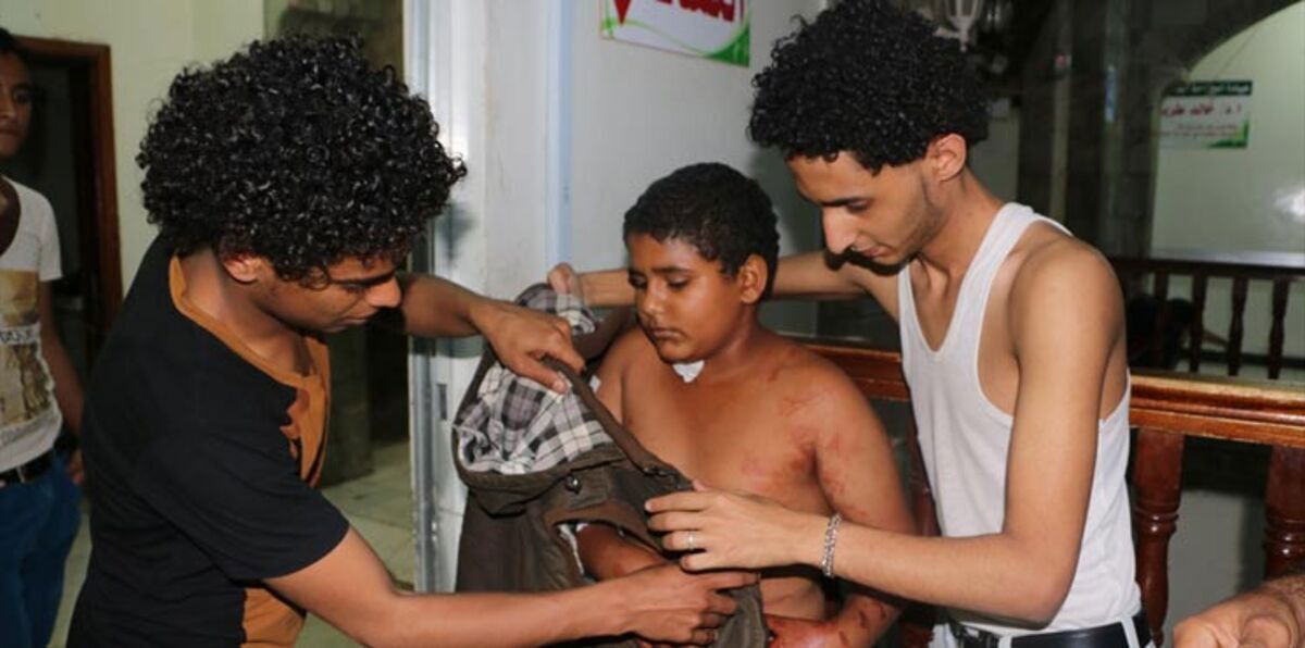 بالصور.. مليشيات الحوثي تقتل وتصيب عشرات الأطفال بأحد الملاعب في تعز