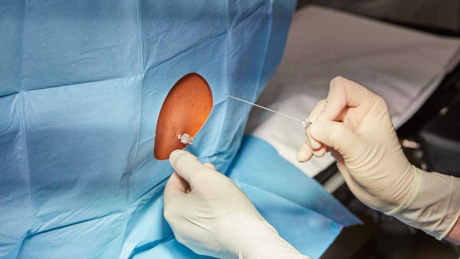 "حقنة الظهر".. كيف تنقذ حياة المرأة بعد الولادة؟