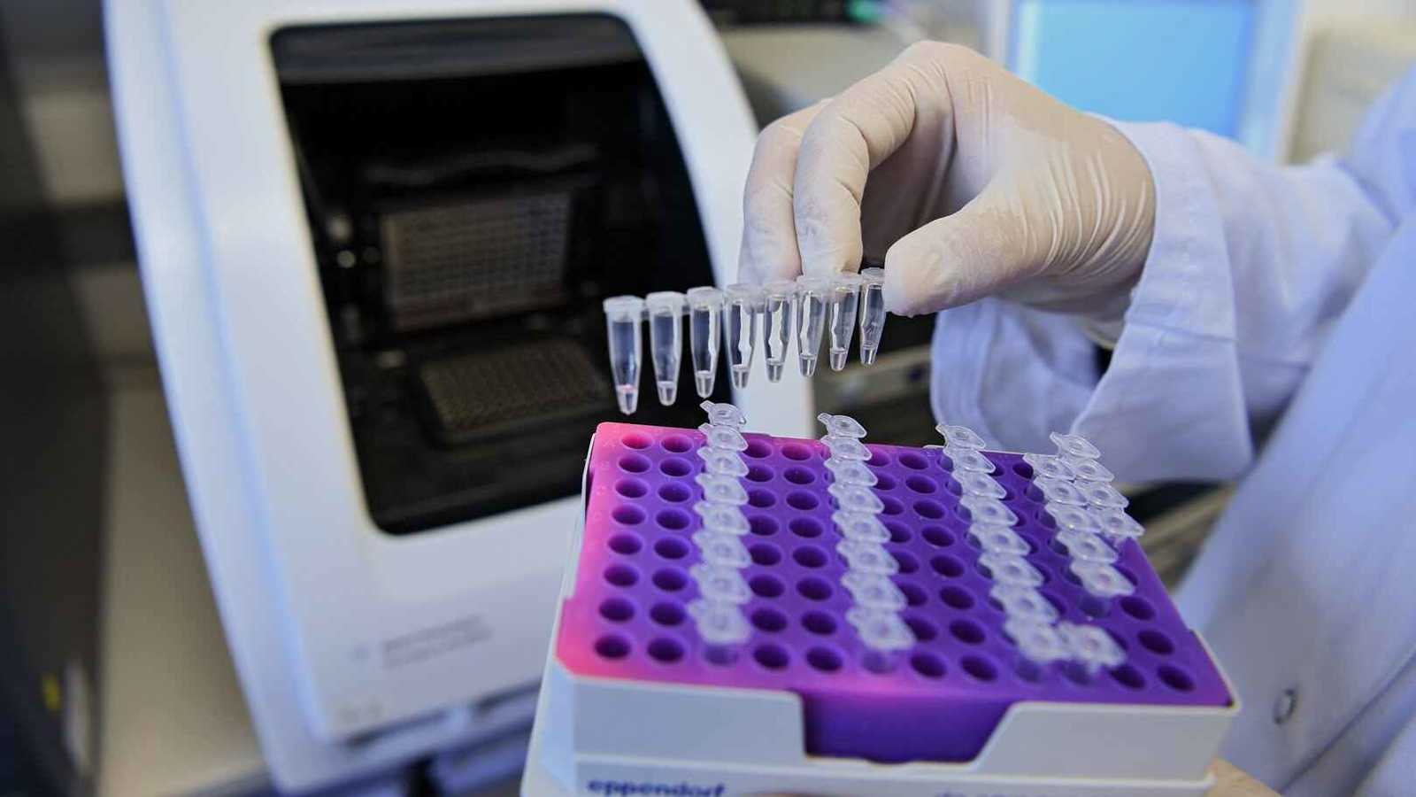 أمريكا تعلن عن أول إصابة بشرية بداء "الدودة الحلزونية"